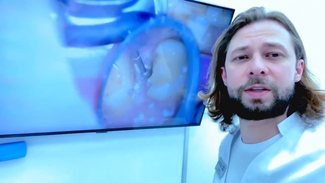 Подготовка зуба , под керамическую вкладку , кариес под пломбой , смотреть онлайн