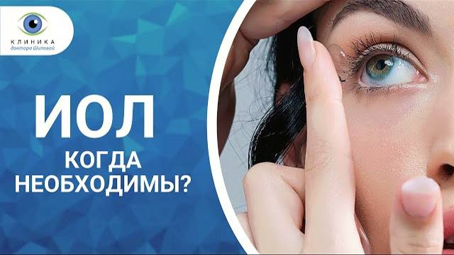 Наш потребнадзор - ИОЛ смотреть онлайн
