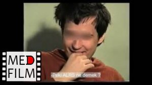 Hebefrenik şizofreni hastası bir Rus hastayla röportaj © Гебефренная шизофрения (турец.)