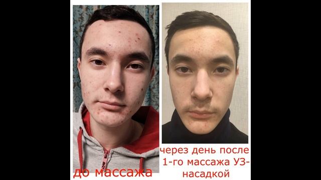 БИОЭНЕРГОМАССАЖЕР FOHOW РЕЗУЛЬТАТЫ В ФОТОГРАФИЯХ смотреть онлайн