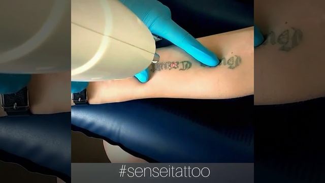 удаление лазером старых татуировок Днепр смотреть онлайн