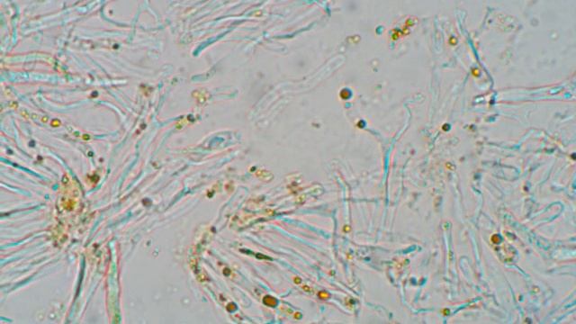 Dacrymyces sp. смотреть онлайн
