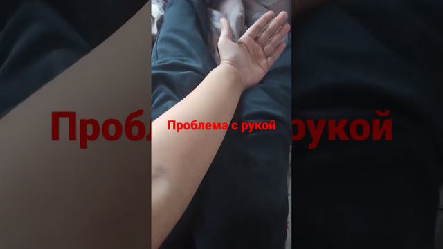 У меня болит Левая рука смотреть онлайн