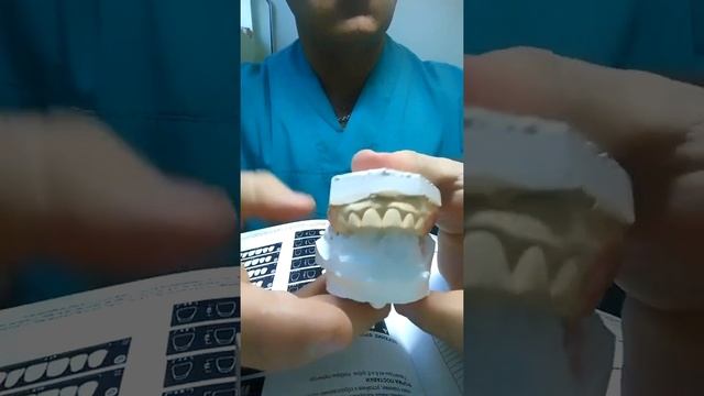 Зубные протезы(термопласт) смотреть онлайн