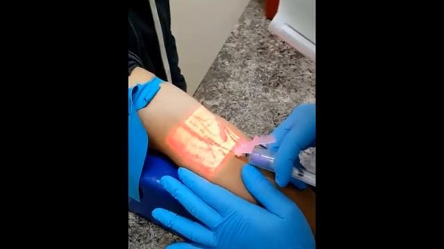 #how vein finder work смотреть онлайн