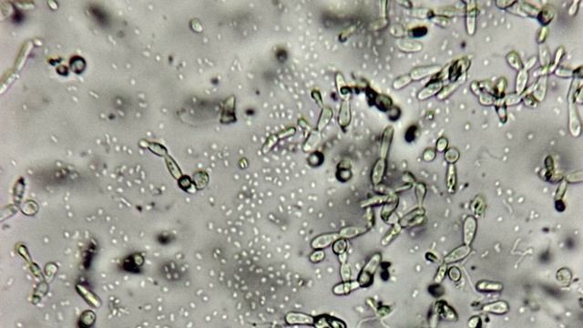 Археи под световым микроскопом смотреть онлайн