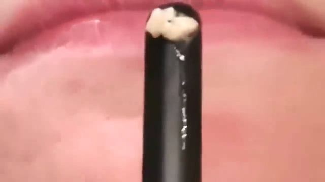 How to remove tonsil stones at home смотреть онлайн
