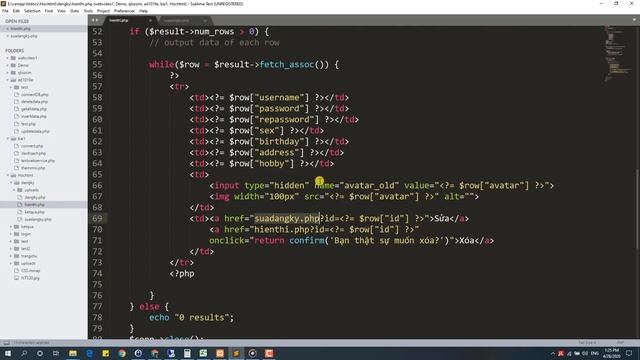 5.6 Xác nhận xóa bằng javascript và sửa ảnh như thế nào смотреть онлайн