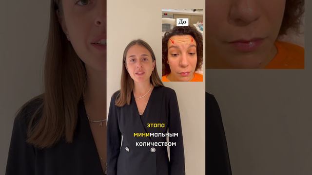 Упали брови после ботокса смотреть онлайн
