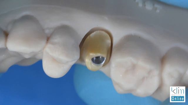 Dental Zirconia Implant Abutments смотреть онлайн