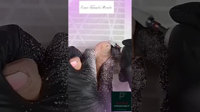 Черные точки на ногте! Опасно или нет?! смотреть онлайн