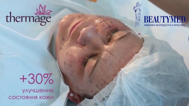 Thermage (Термаж) – это омоложение за одну процедуру, с долгосрочным эффектом