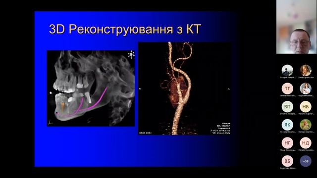 Основні поняття про обробку та аналіз медичних зображень (2к, мед НТН, 2023) смотреть онлайн
