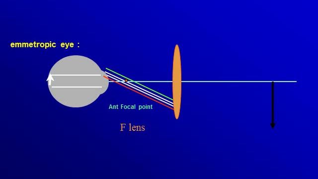 Optics course (new) Indirect Ophthalmoscopy смотреть онлайн