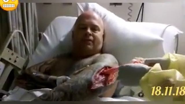 Я ВЫДАВИЛ ПРЫЩ И МНЕ ЧУТЬ НЕ ОТРЕЗАЛИ РУКУ СМОТРЕТЬ смотреть онлайн