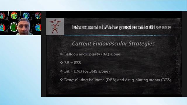 Сессия 4. Эндоваскулярная тромбоэкстракция у пациентов с И Н. Сложные и нерешенные вопросы