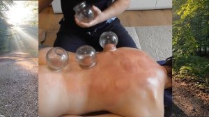 Массаж с банками.