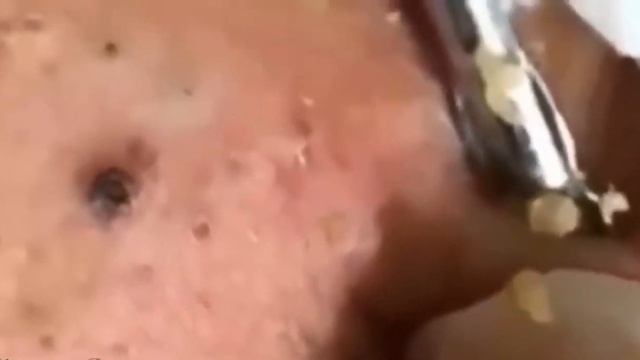 ДАВИМ ЖИРНЫЕ ЧЕРНЫЕ ТОЧКИ