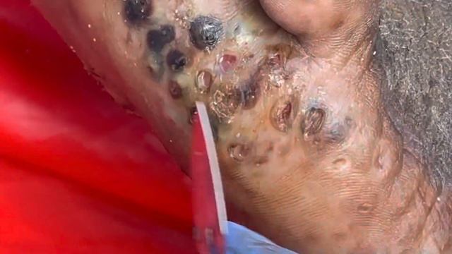 John’s part B of left foot - SO MANY JIGGERS - see full video @riseupsociety.net смотреть онлайн