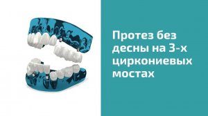 Протезирование без десны на 3 циркониевых мостах