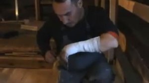 снятие гипса с руки.Самостоятельно