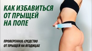Как избавиться от прыщей на попе / ягодицах.