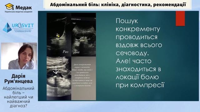 Абдомінальний біль - найлегший чи найважчий діагноз?         Рум'янцева Дарія Вадимівна (Львів)