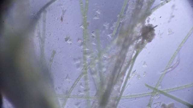 Инфузории сувойки под микроскопом смотреть онлайн