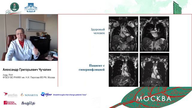 D1. Трансплантация лёгких смотреть онлайн