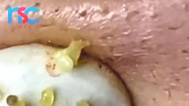 Relax Every Day With Loan Nguyen Spa #DDR 4