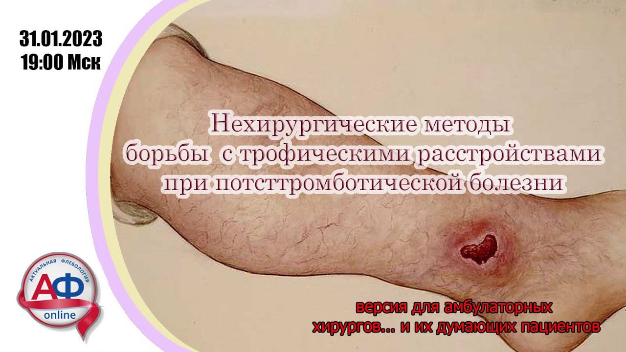 Нехирургические методы борьбы с трофическими расстройствами при посттромботической болезни смотреть онлайн