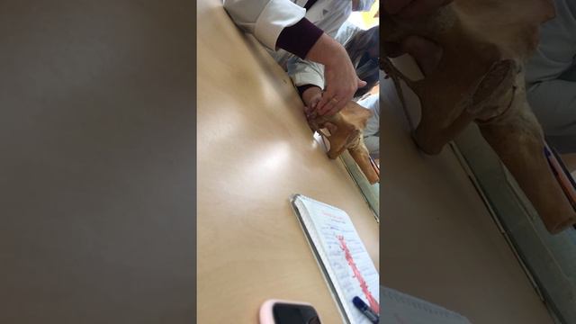 Подвздошная артерия (1) смотреть онлайн