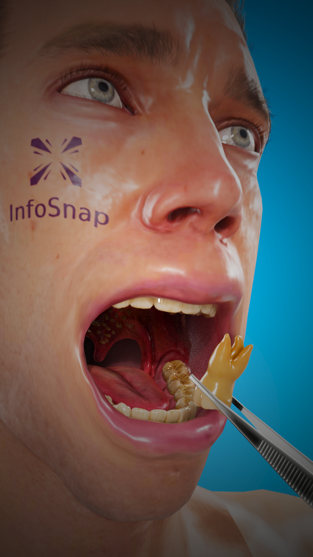 Зубы на нёбе? 😨