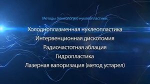 Нуклеопластика методом интервенционной дискотомии