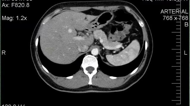 кт органов с контрастом смотреть онлайн