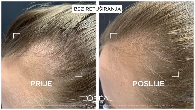 L'Oréal Paris Elseve Full Resist Aminexil Serum Protiv Opadanja Kose