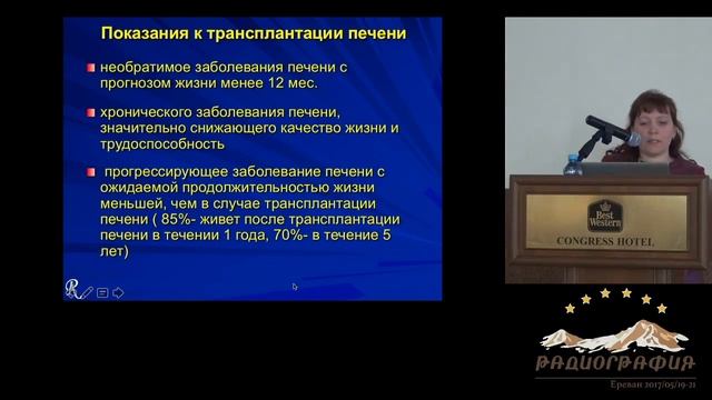 Анна Кудрявцева. КТ диагностика цирроза печени и лист ожидания трансплантации печени.