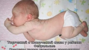 Как распознать судороги у ребенка — признаки проявления