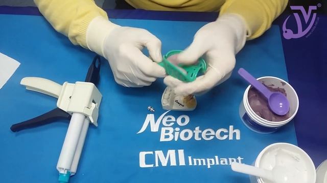 Снятие слепка закрытой ложкой смотреть онлайн