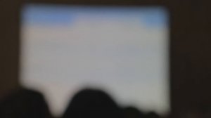 УЗИ вен малого таза (7 Съезд РАСУДМ УЗИ)