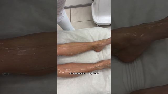 Лазерная эпиляция мой опыт Rīgas Lāzer Klinika #lazer #epilation #эпиляция #лазер #лазернаяэпиляция