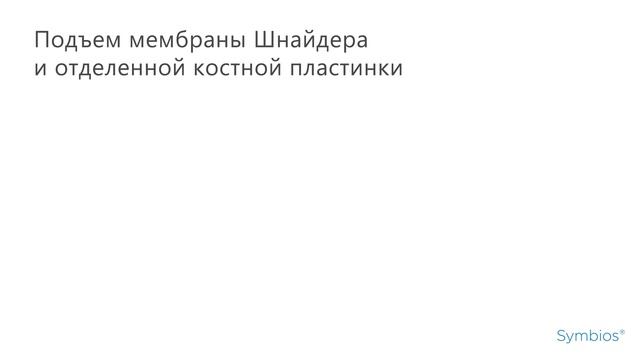 Cинуслифтинг с применением материала Symbios Xenograft смотреть онлайн