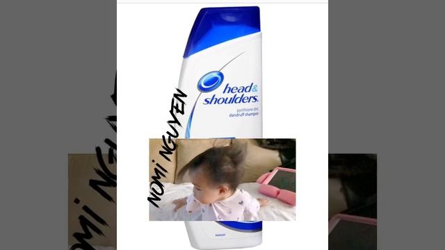 Head And Shoulder Funny Commercial