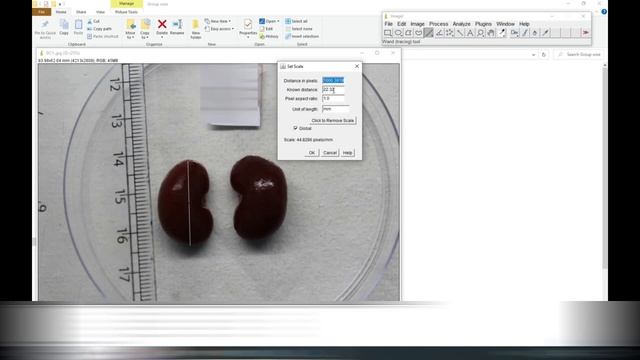 Image J length and width measurement tool смотреть онлайн