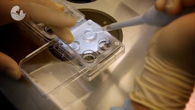 Лечение бесплодия: оплодотворение яйцеклетки смотреть онлайн