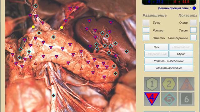 #Сахарный Диабет и #Паразиты смотреть онлайн