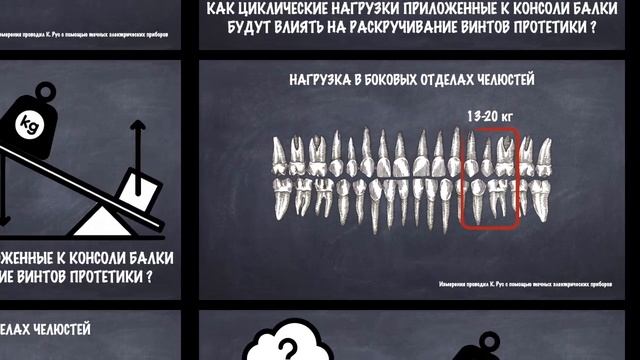 Консоли, имплантаты и нагрузки смотреть онлайн