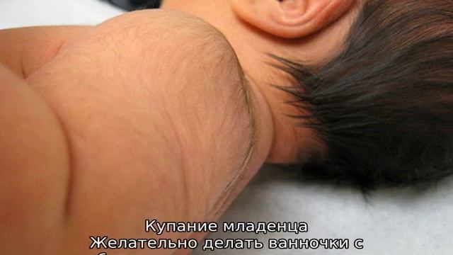 Лануго у новорожденных — что это такое, когда исчезает смотреть онлайн