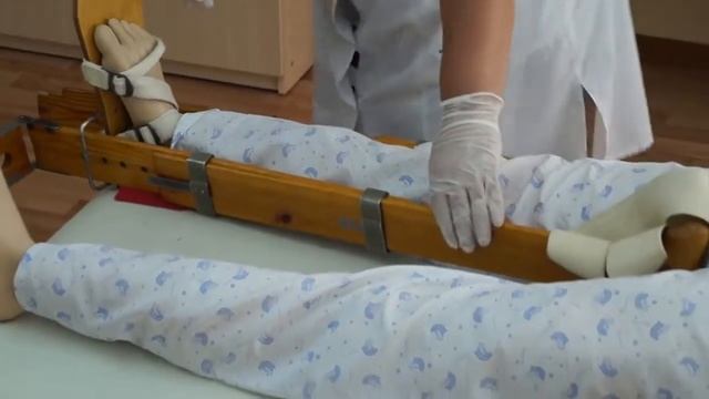 Транспортная иммобилизация при закрытых переломах нижних конечностей (перелом бедренной кости) смотреть онлайн