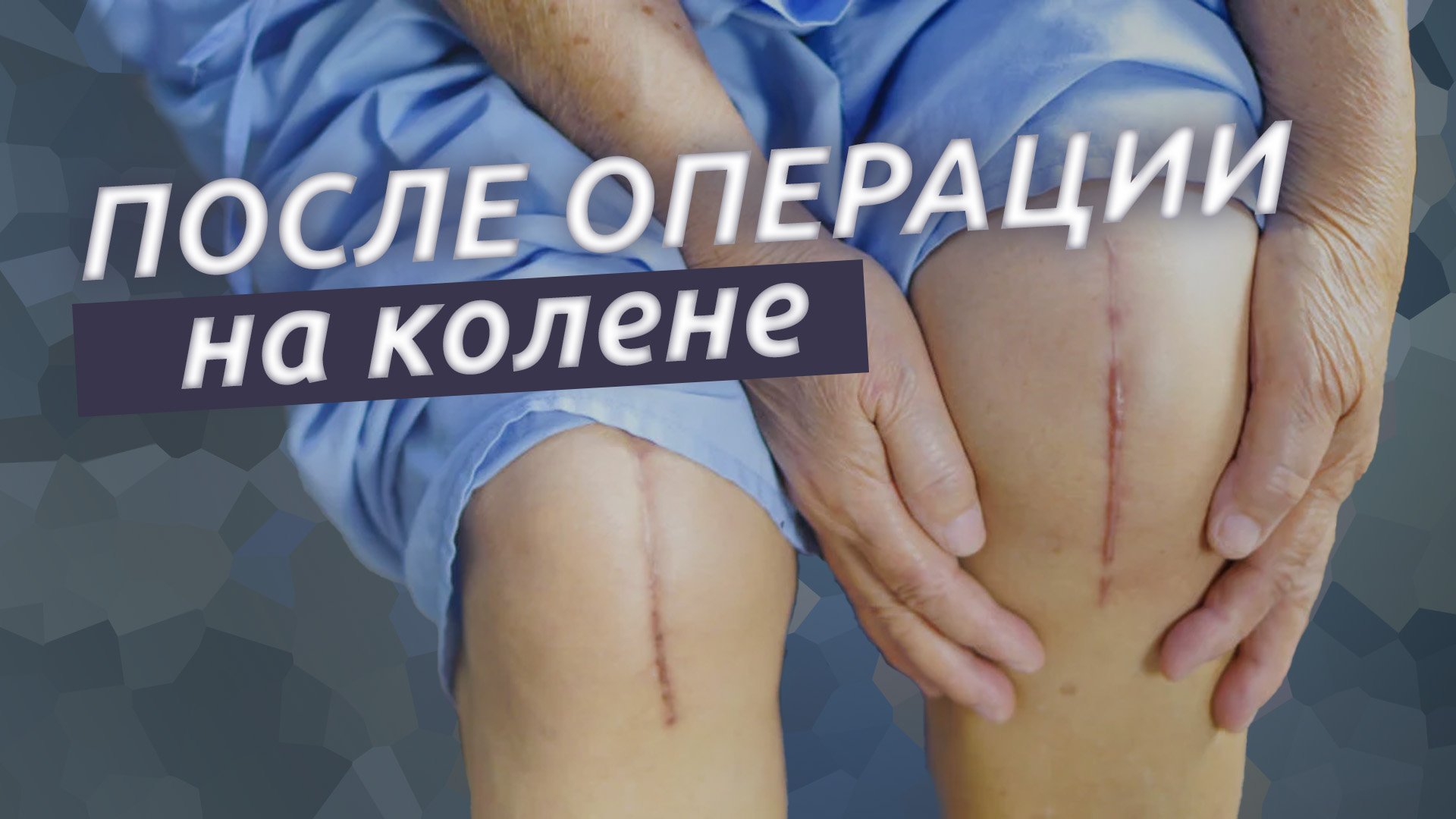 После операции на колене. Первые 2 недели. смотреть онлайн